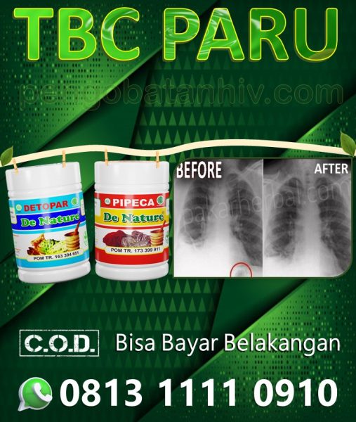 Obat Tbc Tuberkulosis Paru Herbal Paling Ampuh Merek De Nature Di Apotik